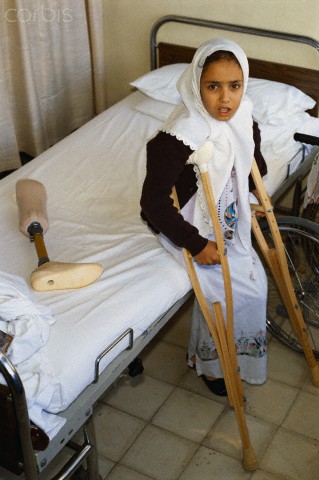ca. 1989, Jerusalem, Israel --- Sabrina, a 12-year-old amputee wounded by a bullet during the Intifada, waits for her physical therapist in Mokassed Hospital in Jerusalem. --- Image by Ricki Rosen/CORBIS SABA